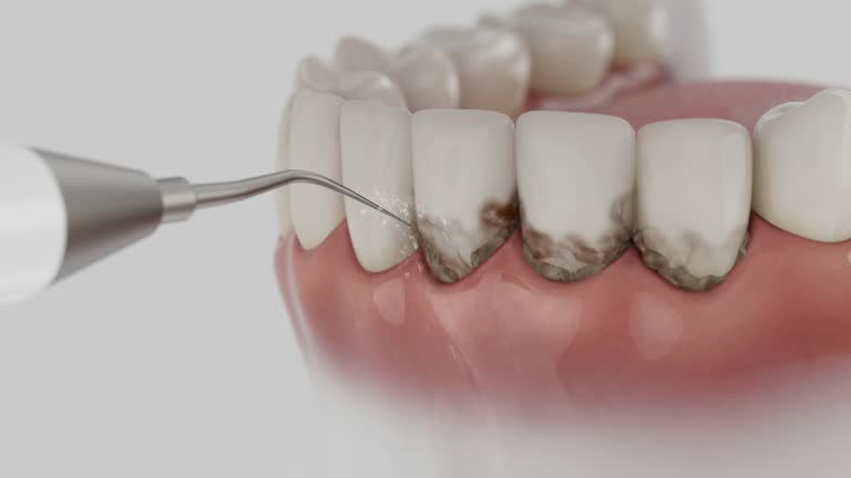 Reliable Tooth Extraction contractor in Livingston County County, MO by Dentist Open Now